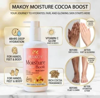 Makoy Body Lotion Cocoa Butter for Dry Skin Deeply Moisturizing Daily Care for Soft & Smooth Nourishment Healthy Skin | (200ml)