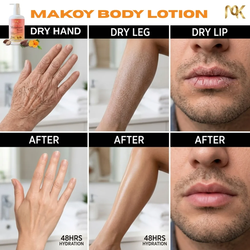 Makoy Body Lotion 48 hours hydration result for dry hands, dry legs and cracked lips.
