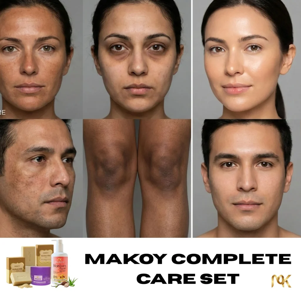 Makoy Complete Care Set results showing full body transformation for face, under-eyes, and knees using Makoy Multani Mitti Soap, Night Cream, and Cocoa Body Lotion