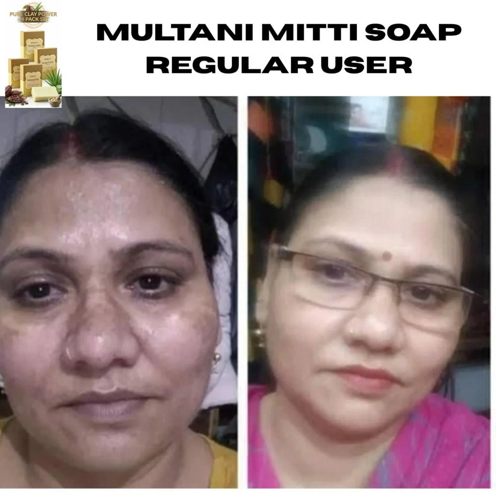Makoy 100% Natural Multani Mitti Soap result infographic showing benefits for oily skin, tan removal, and daily face wash with before and after comparison.