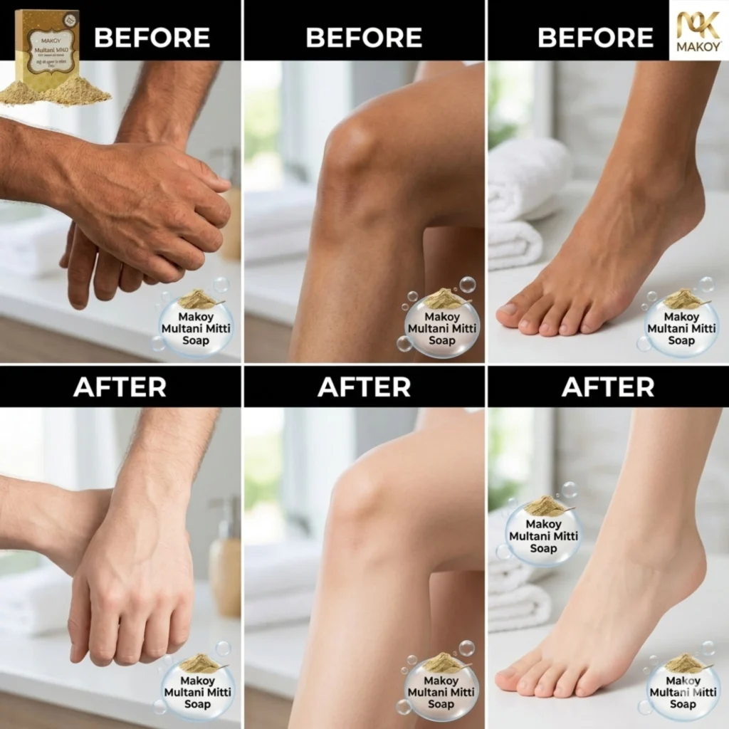 Makoy Multani Mitti Soap before and after results for full body tan removal on hands, legs, and feet. Natural Ayurvedic de-tan soap