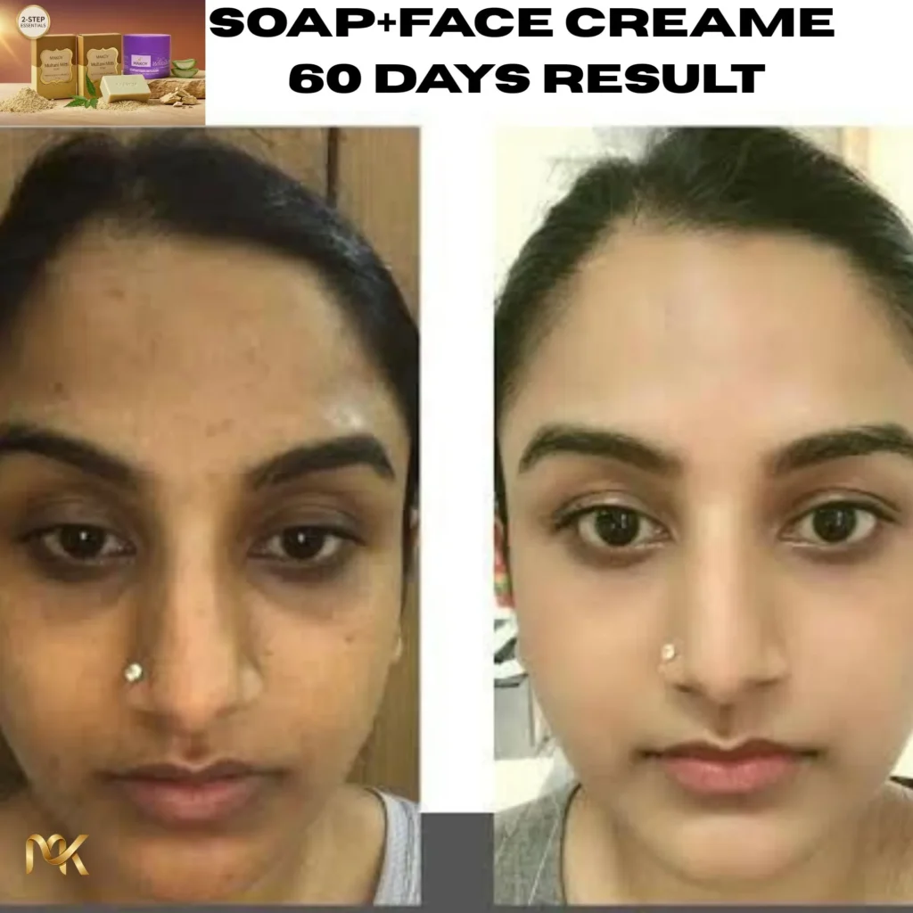 Makoy Multani Mitti Tan Removal Soap box with pure Multani Mitti powder mounds and key ingredients: Natural Multani Mitti, Natural Soap Base, Glycerine. Benefits include deep cleanse, tan removal, and skin hydration